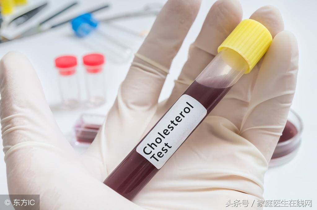 糖尿病的成因，深度解析其背后的原因，深度解析糖尿病成因，揭示背后原因真相