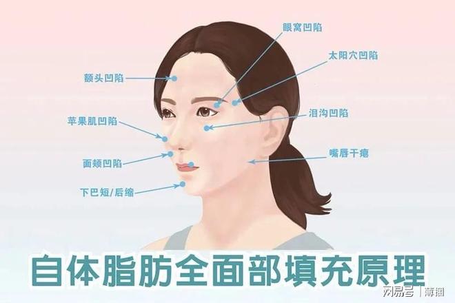 脂肪填充后幾天開始存活，全面解析脂肪填充過程及其恢復時間，全面解析脂肪填充過程，術后幾天脂肪開始存活及恢復時間揭秘