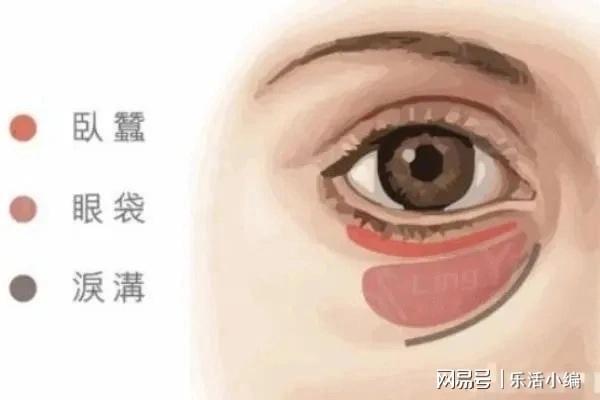 眼袋切除手術(shù)費(fèi)用詳解，價(jià)格因素與如何選擇合適的手術(shù)方案，眼袋切除手術(shù)費(fèi)用解析，了解價(jià)格因素與選擇最佳手術(shù)方案