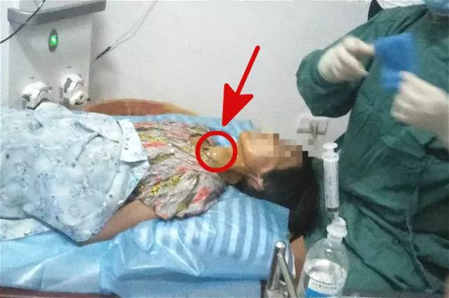 甲狀腺結(jié)節(jié)4A持續(xù)二十年，深入了解與管理，甲狀腺結(jié)節(jié)二十年持續(xù)觀察與管理策略